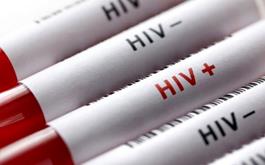 شناسایی گونه جدید HIV در هلند