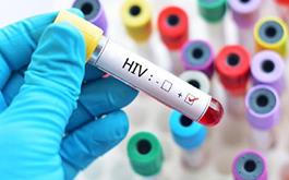 آشنایی با ویروس HIV (ایدز) به مناسبت 10 آذر روز جهانی ایدز
