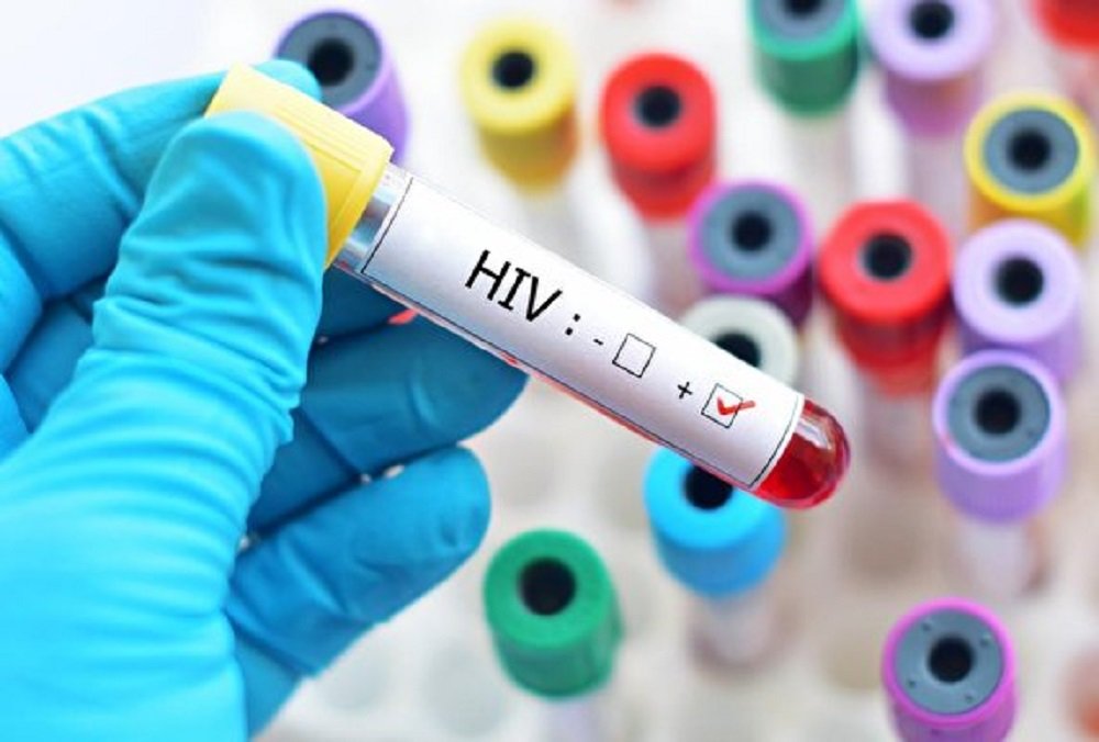 آشنایی با ویروس HIV (ایدز) به مناسبت 10 آذر روز جهانی ایدز