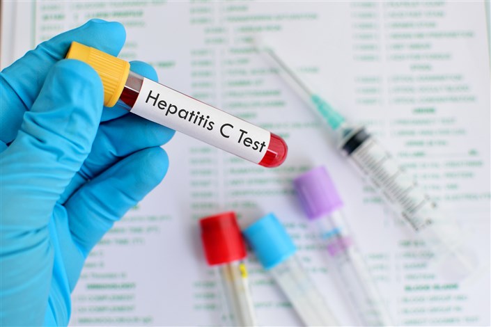 ایران از معدود کشورهای تولیدکننده داروی هپاتیت C
