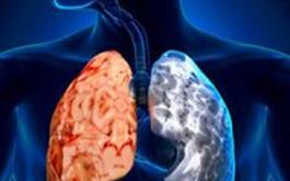اثرات آلودگی هوا برای بیماران مزمن تنفسی