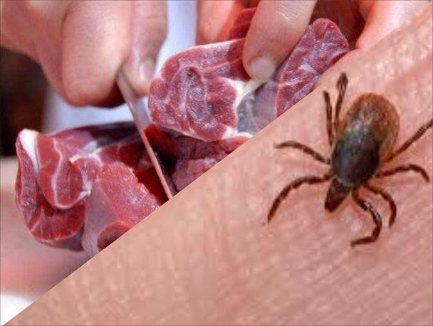 گزارش یک مورد قطعی بیماری تب کریمه‌کنگو در اردبیل